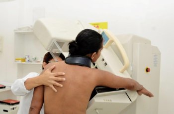 Mamografia garante o diagnóstico precoce e assegura o tratamento em tempo oportuno