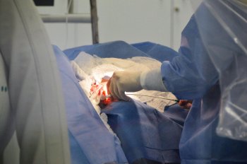 Segundo a Central de Transplantes de Alagoas, já foram realizados no Estado nove transplantes de córneas, dois de rins e um de fígado de janeiro até agora. Carla Cleto / Ascom Sesau