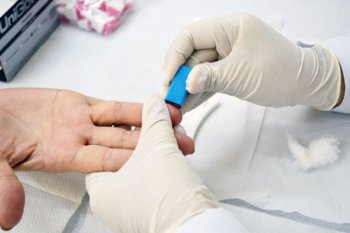Cerca de 400 testes rápidos para hepatite B e C serão realizados para a populaçãoAna Paula Tenório