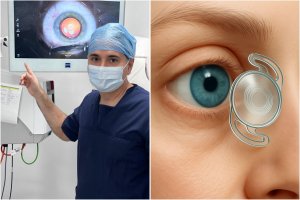 Professor da Uncisal lidera criação de lente para catarata aprovada pela Anvisa e reconhecida internacionalmente