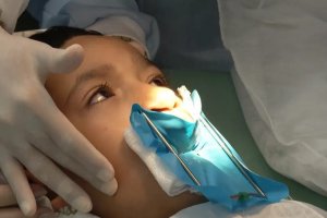Lei determina SUS a fazer cirurgia reconstrutiva de lábio leporino