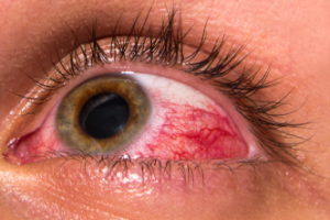 Seus olhos estão te dando um alerta?