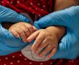 SUS passa a oferecer tratamento inovador de atrofia muscular espinhal