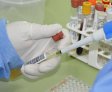 Com 7 casos este ano em Alagoas, Sesau reforça medidas de prevenção contra meningite