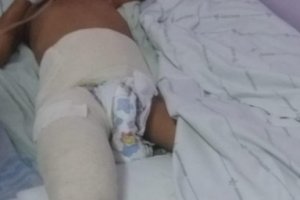Prefeitura de Palmeira repudia violência contra criança provocada pela mãe e padrasto